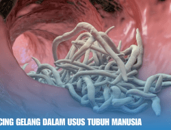 Bahaya Cacing Gelang dalam Usus Tubuh Manusia