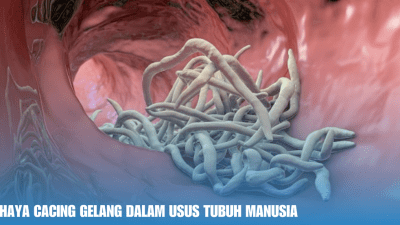 Bahaya Cacing Gelang dalam Usus Tubuh Manusia
